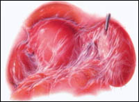 和女性朋友谈盆腔炎