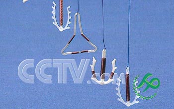 戴避孕环后您应该注意什么?